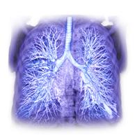 Мультиспиральная компьютерная томография (МСКТ) органов грудной клетки (легких) с виртуальной бронхоскопией и записью исследования на DVD