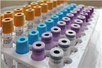 ПЦР-диагностика (анализ) Молекулярно-генетическое исследование HLA-B27 (тест 1334,ЭДТА) (7р.д.) (инвитро)