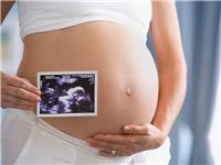 Диагностика ультразвуковая (УЗИ) беременности, ультразвуковой скрининг, срок 10-14 недель